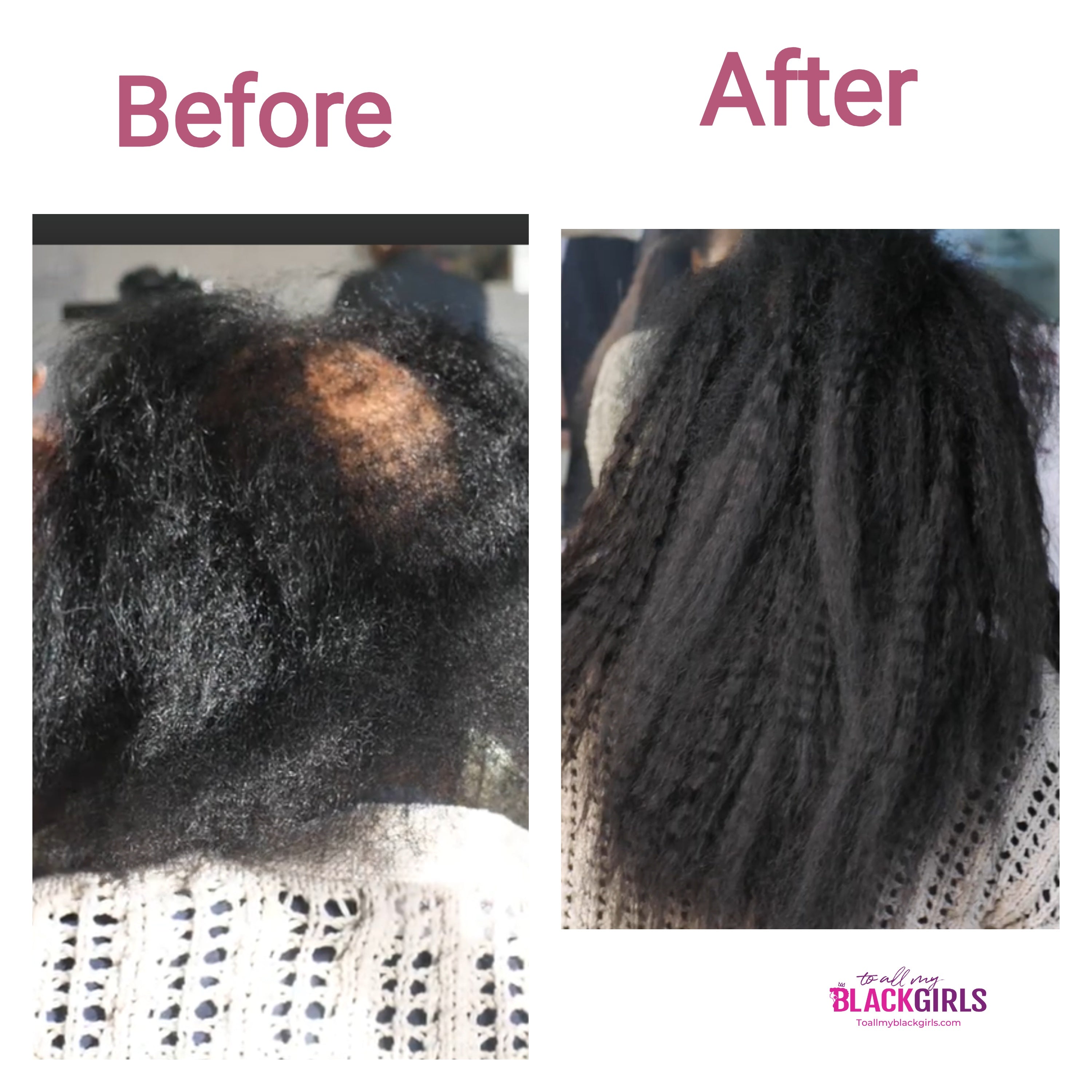 Curly Microlinks (I-tip) Extensions- Kinky Curly Straight Coarse Afro