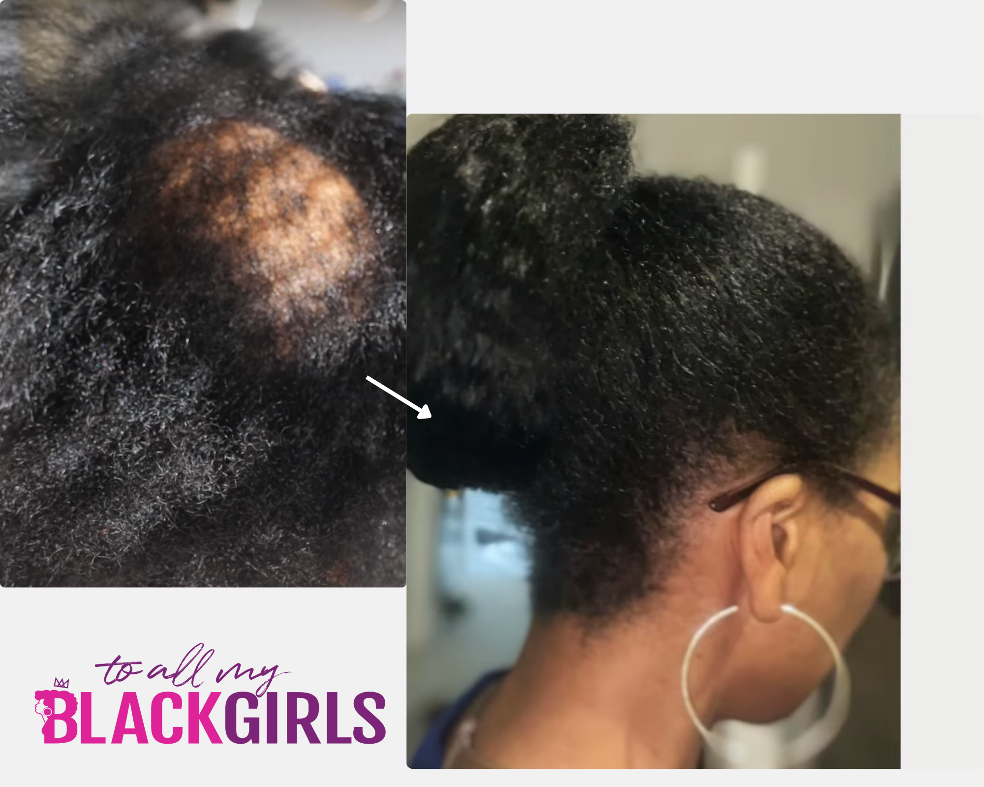 Hair Appointment Bookings: Microlink, Tape-Ins & Clip Ins
